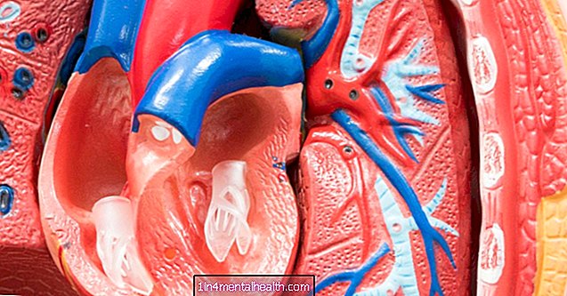 Kaj se zgodi med atrijsko fibrilacijo? - srčna bolezen