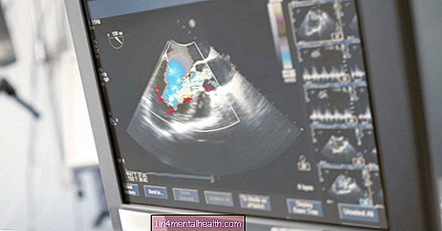Apa itu echocardiogram? - penyakit jantung