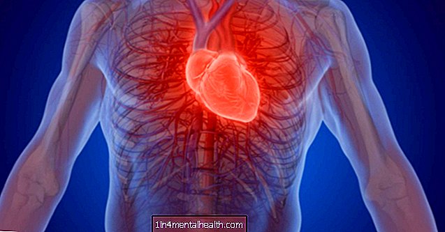 Vem är mest utsatt efter en hjärtinfarkt?