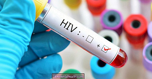 Kan detta implantat skydda kvinnor från HIV? - hiv-and-aids