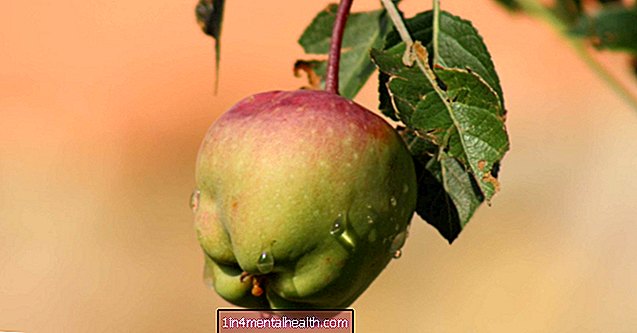 Er eplebakterier gode eller dårlige? Det kommer an på eplet - smittsomme sykdommer - bakterier - virus