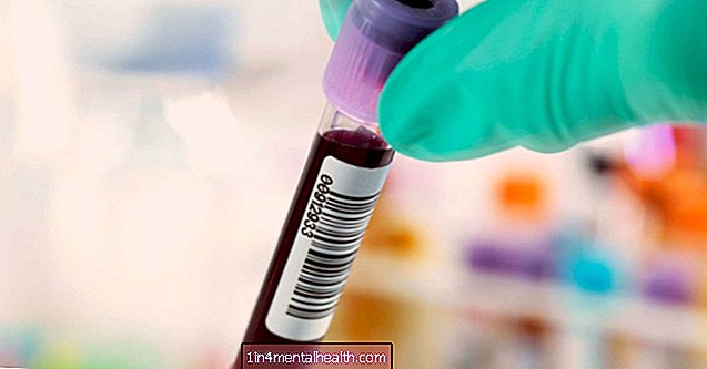 O que saber sobre falsos positivos em testes de hepatite C
