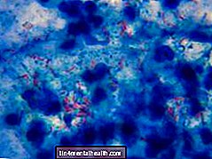 Ką reikia žinoti apie superbugą NDM-1 - infekcinės ligos - bakterijos - virusai