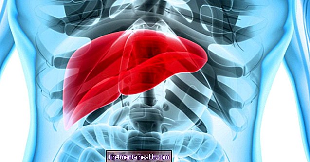 Hepatosplenomegali: Alt hvad du behøver at vide - leversygdom - hepatitis