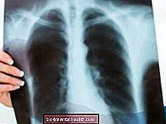 Kas jāzina par plaušu mezgliem