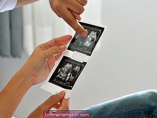 18-týždňový ultrazvuk: Typy, postup a obmedzenia - zdravotnícke prístroje - diagnostika