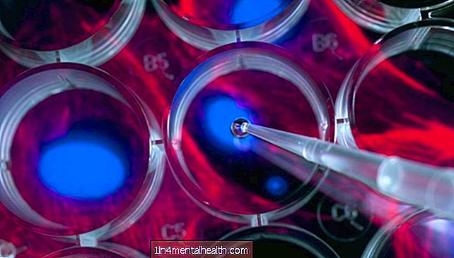 Firmy sprzedające ryzykowne produkty z komórek macierzystych otrzymują ostrzeżenie FDA - innowacje medyczne
