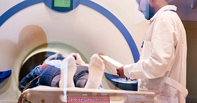 MS: MRI z visoko trdnostjo lahko napove napredovanje bolezni - multipla skleroza