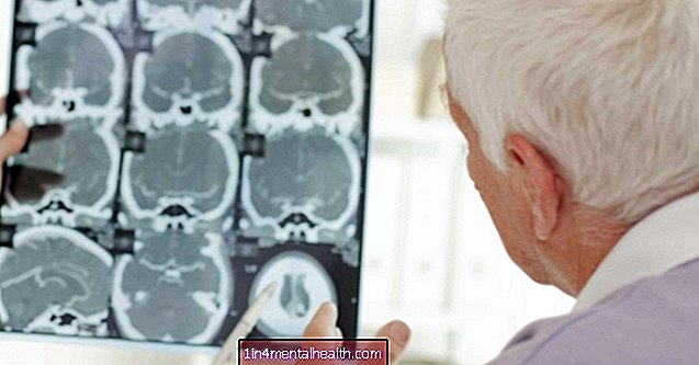 Sel-sel otak terus tumbuh hingga usia 70-an - neurologi - ilmu saraf
