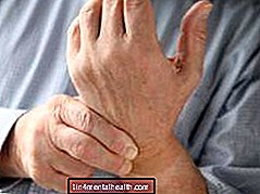 손목 터널 증후군 : 알아야 할 사항 - 신경학-신경 과학