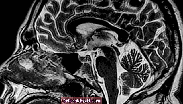 Skúmanie neuroanatómie vraha - neurológia - neuroveda