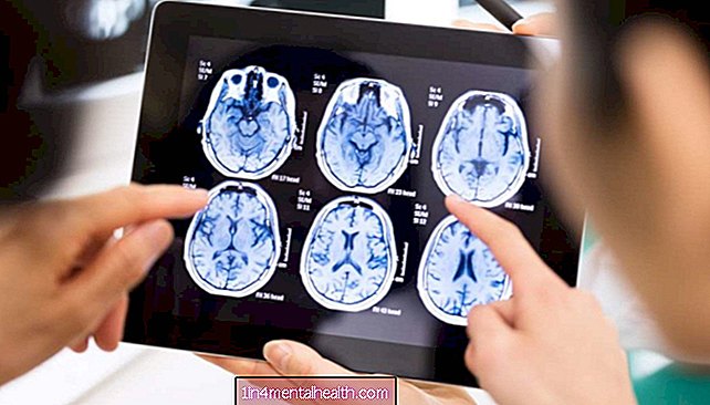 neiroloģija - neirozinātne - Jauns algoritms izmanto smadzeņu skenēšanu, lai pateiktu, cik gudrs tu esi