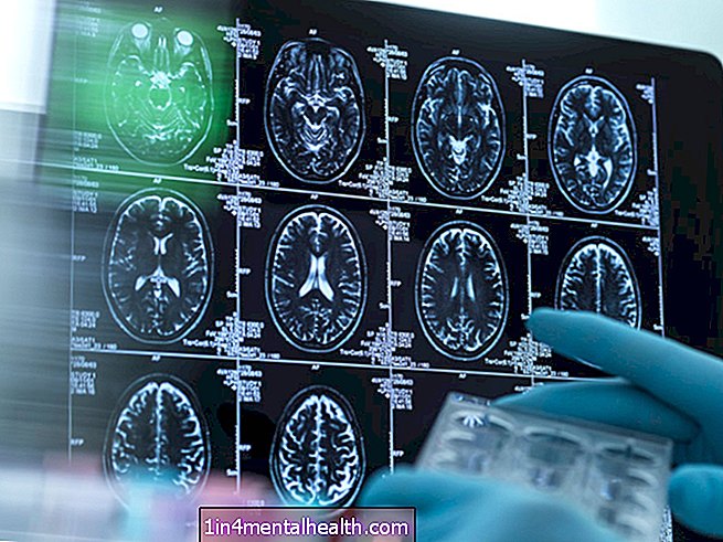 ¿Qué es la neurociencia? - neurología - neurociencia