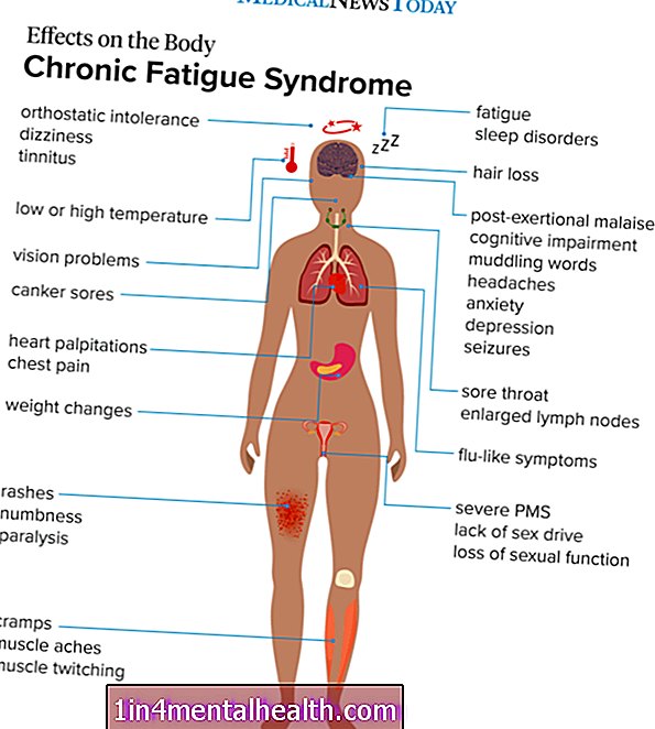 Що слід знати про синдром хронічної втоми - неврологія - неврологія