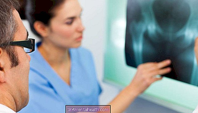 Osteoporoz: Selenyum riski azaltabilir mi? - kemik erimesi
