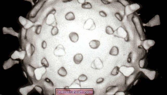 rak jajčnikov - Virusi, reprogramirani za napad na raka