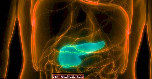 Rak trzustki: zmodyfikowany wirus grypy niszczy guzy - rak trzustki
