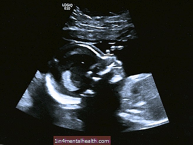 těhotenství - porodnictví - Co se stane na 20týdenním ultrazvuku?