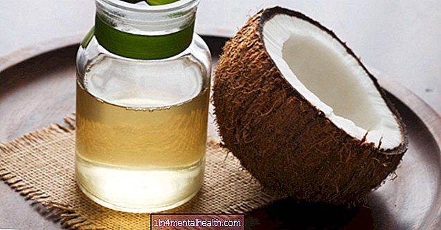 ココナッツオイルは乾癬の治療に役立ちますか？