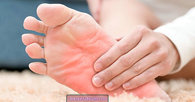 Hoe kan artritis psoriatica de voeten beïnvloeden? - psoriasis