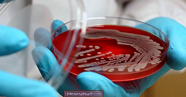 Superbugs: tutto ciò che devi sapere - salute pubblica