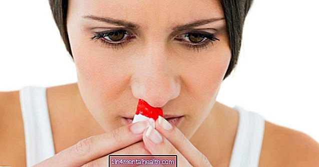 Какво причинява кървене от носа през нощта? - общественото здраве