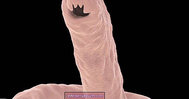 Mitä tietää hookworm-infektiosta?