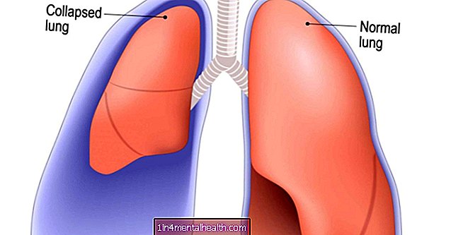 Apa yang mesti anda ketahui mengenai paru-paru yang berlubang - sistem pulmonari