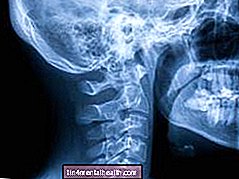 Jsou rentgenové snímky opravdu bezpečné? - radiologie - nukleární medicína