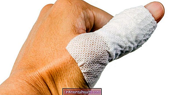 Jak víte, že máte podvrtnutý palec? - revmatoidní artritida