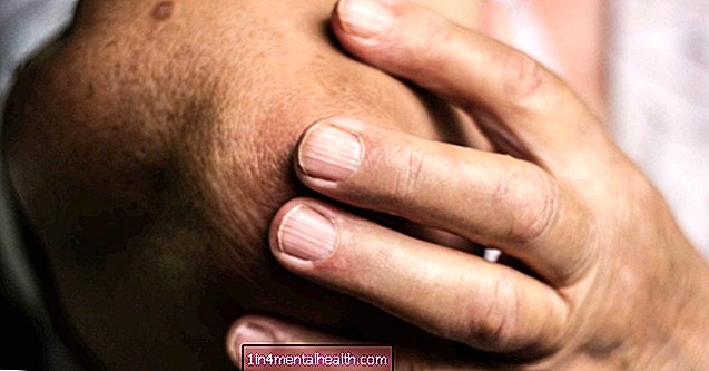 Como a artrite reumatóide afeta o cotovelo?