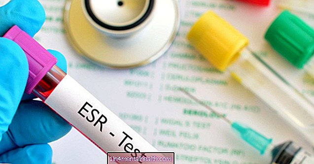 Što znači ako vam je ESR visok? - reumatoidni artritis