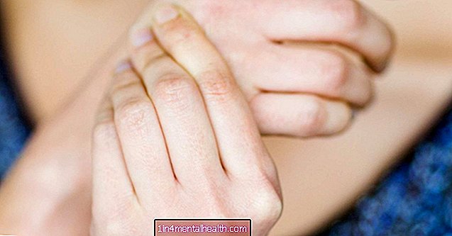 Која је веза између улцерозног колитиса и болова у зглобовима? - реуматоидни артритис