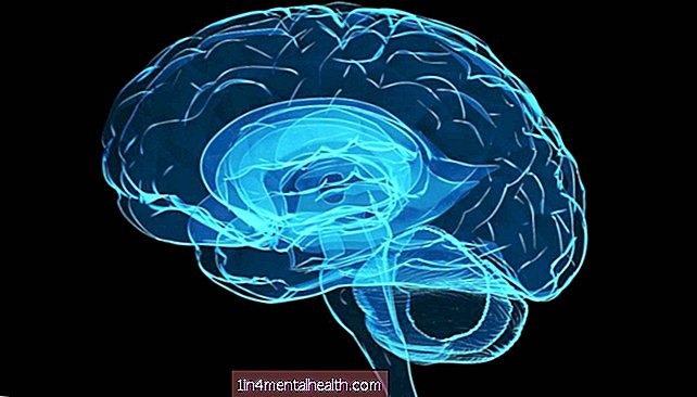 Nekatere možganske funkcije se lahko po smrti obnovijo, kaže študija prašičev - možganska kap