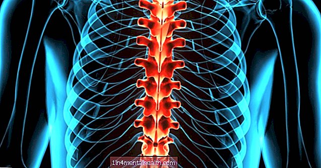 Spinalna kap: vzroki, zdravljenje in izid - možganska kap