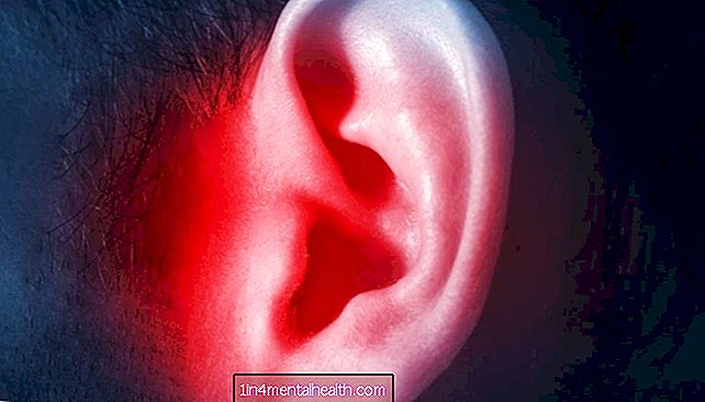 cirugía - Cómo tratar y prevenir el barotrauma del oído