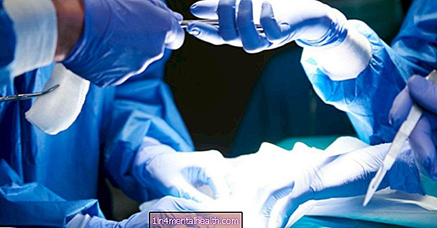 Jaké jsou nejbolestivější operace? - chirurgická operace