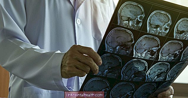 Những điều cần biết về shunt não thất - phẫu thuật