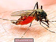 Što znati o malariji - tropske-bolesti