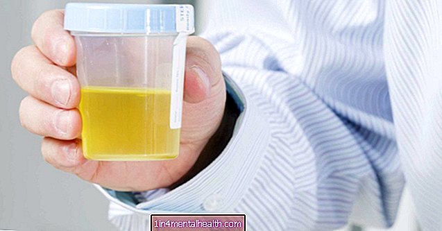 Epitelceller i urin: Hva betyr det? - urinveisinfeksjon