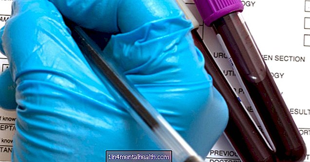 Hvad er en differentiel blodprøve? - urinvejsinfektion