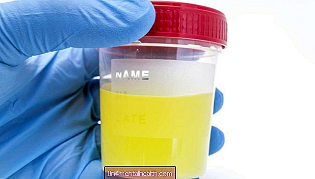 Hvorfor lukter urinen min som fisk? - urinveisinfeksjon