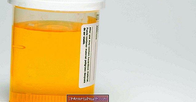 Varför luktar min urin svavel? - urinvägsinfektion
