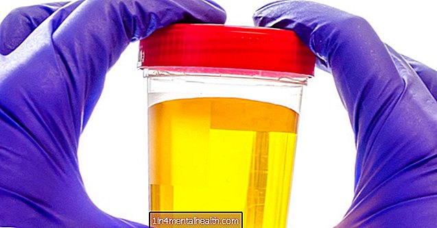Varför är min urin ljusgul? - urinvägsinfektion