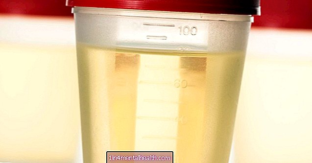 Hvad betyder det at have nitrit i urinen? - urologi - nefrologi