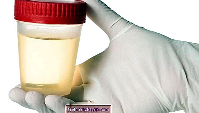 Zakaj moj urin diši po amoniaku? - urologija - nefrologija