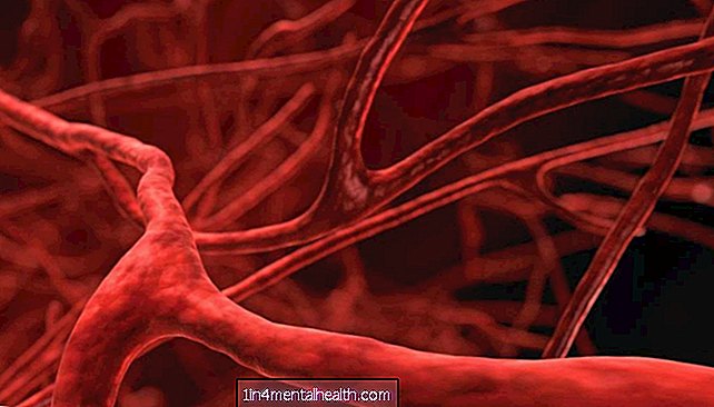 Kuinka verisuonten terveys voi johtaa IBD: hen - verisuoni